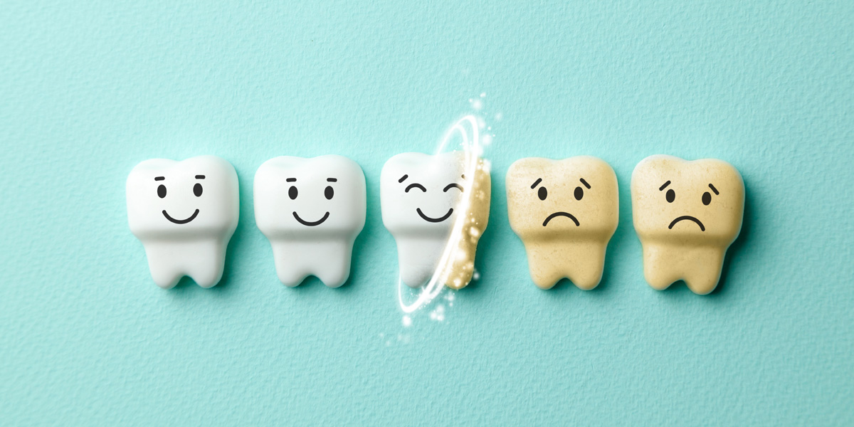 Teeth whitening
