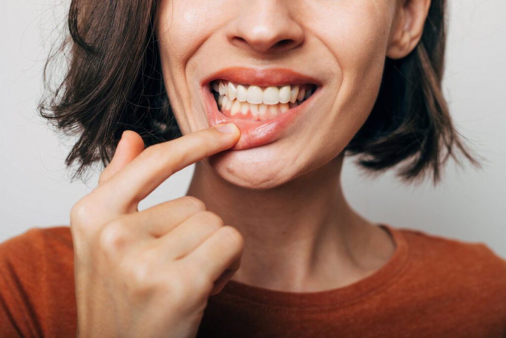 AdobeStock 543725614 - Ponce Dental Studio