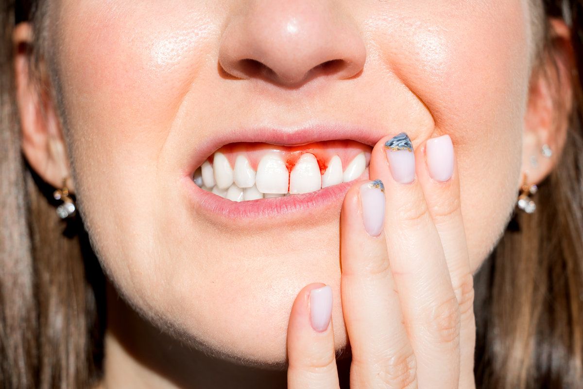 Woman filling pain because of bleeding gums. Periodontal disease, avitaminosis, gingivitis, scurvy